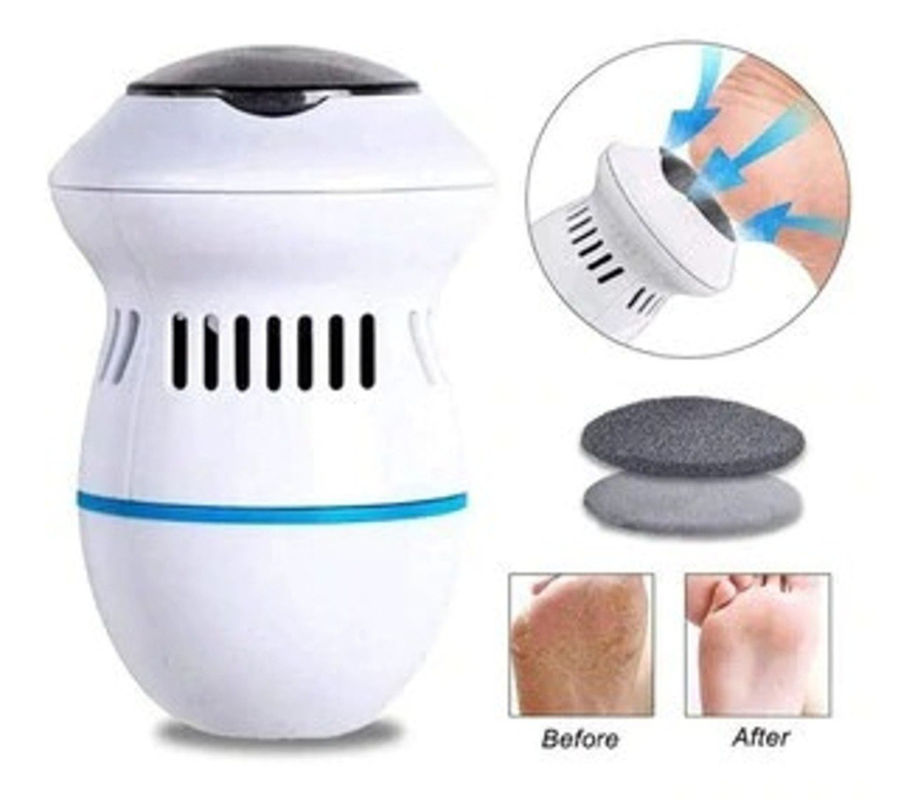 🔥HOT-SALE🔥 Nueva amoladora eléctrica para pies Skin Hard Breakout Skin Trimmer Dead Skin